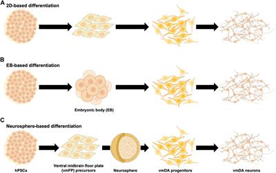 Challenges involved in cell therapy for Parkinson’s disease using human pluripotent stem cells